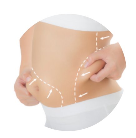 CoolSculpting
