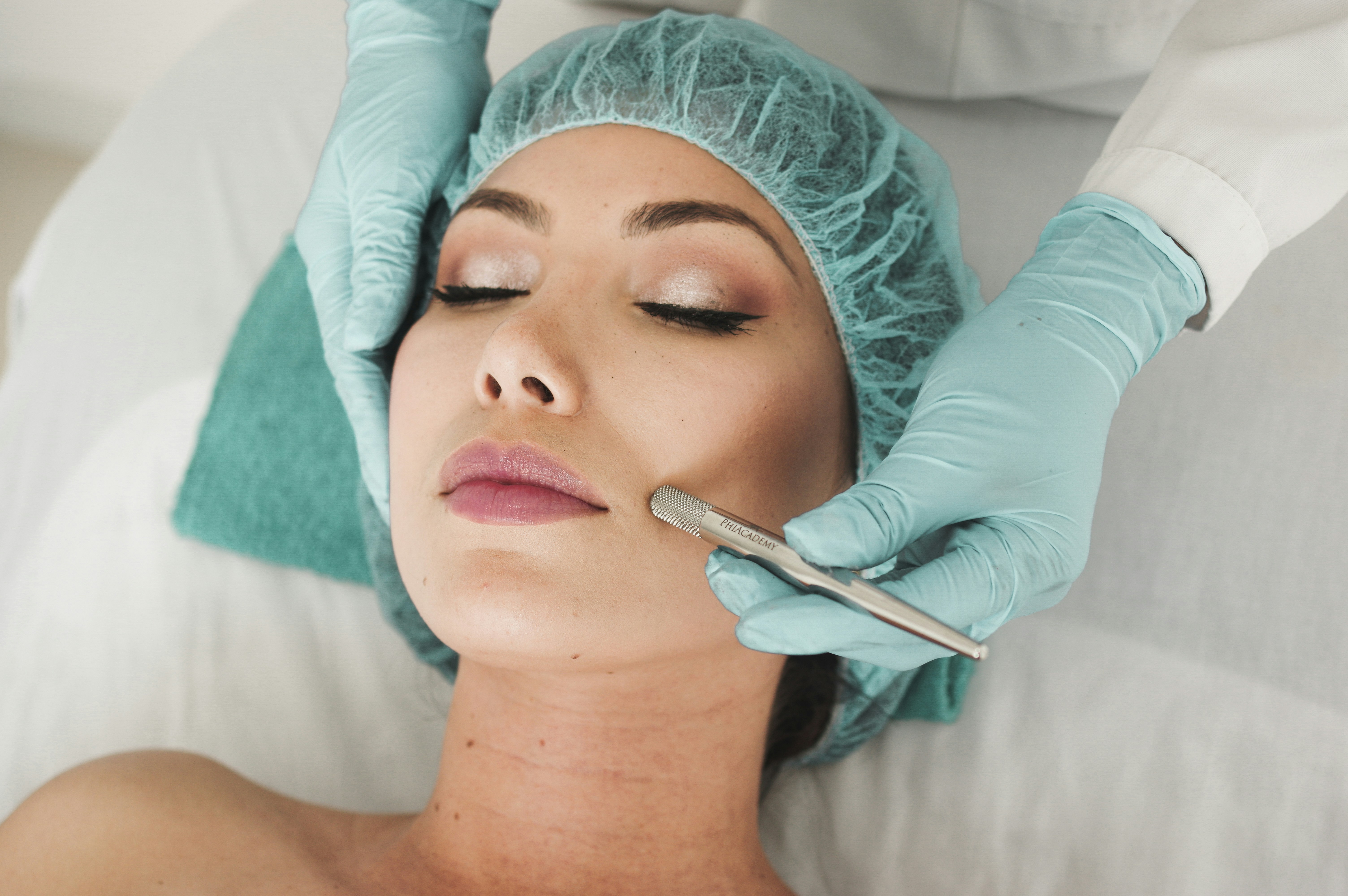 Chemical Peels