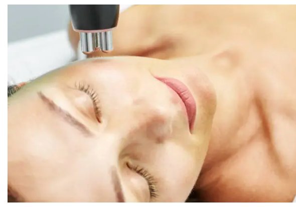 Forma Skin Tightening